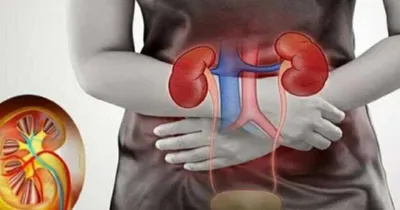 kidney failure  ದೇಹದಲ್ಲಿ ಈ ಲಕ್ಷಣ ಕಂಡುಬಂದ್ರೆ ಕಿಡ್ನಿ ಫೇಲ್ಯೂರ್ ಆಗೋದು ಪಕ್ಕಾ ಎಂದರ್ಥ   