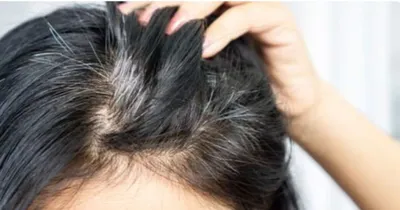 white hair home remedies  ಕೂದಲನ್ನು ಕಪ್ಪಾಗಿಸಲು ಈ ಮೂರೇ ಮೂರು ವಸ್ತು ಸಾಕು  ಜೀವಮಾನದಲ್ಲಿ ಬಿಳಿ ಕೂದಲೇ ಬರೋದಿಲ್ಲ  