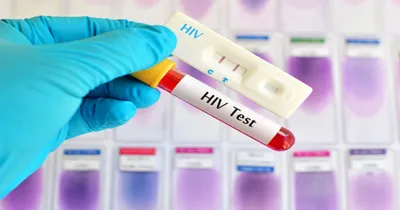 students hiv case  828 ವಿದ್ಯಾರ್ಥಿಗಳಲ್ಲಿ hiv ಪಾಸಿಟಿವ್‌  47 ವಿದ್ಯಾರ್ಥಿಗಳಿಗೆ ಏಡ್ಸ್‌  ಆಘಾತಕಾರಿ ವಿಷಯ ಬಹಿರಂಗ